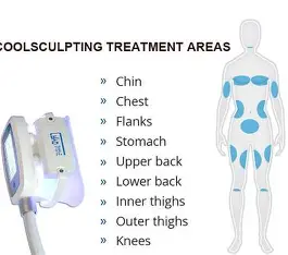 Ideal Treatment Areas