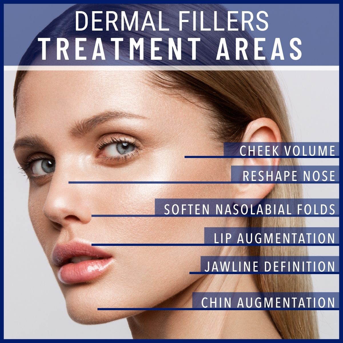 Dermal Fillers