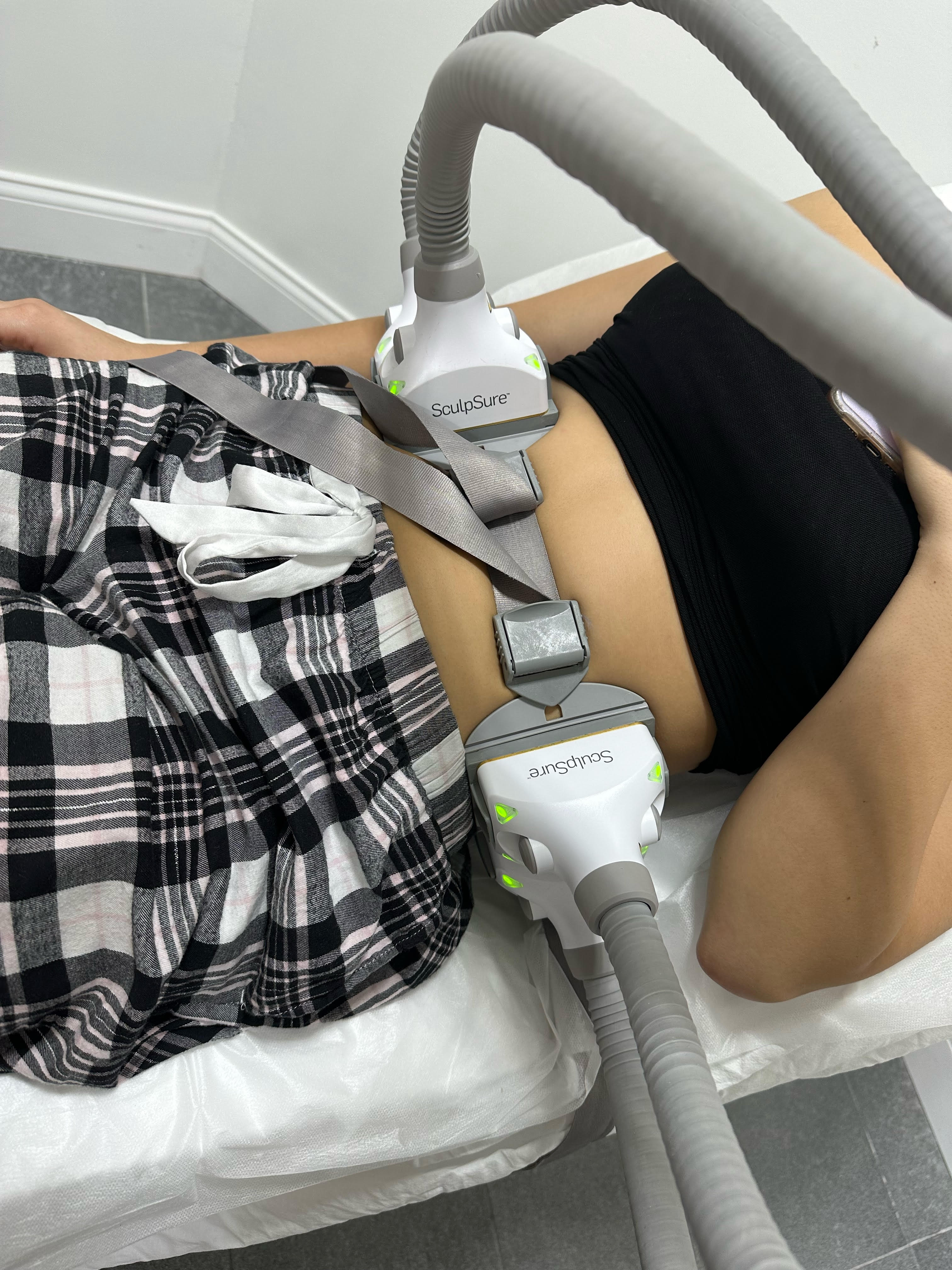 SculpSure Image